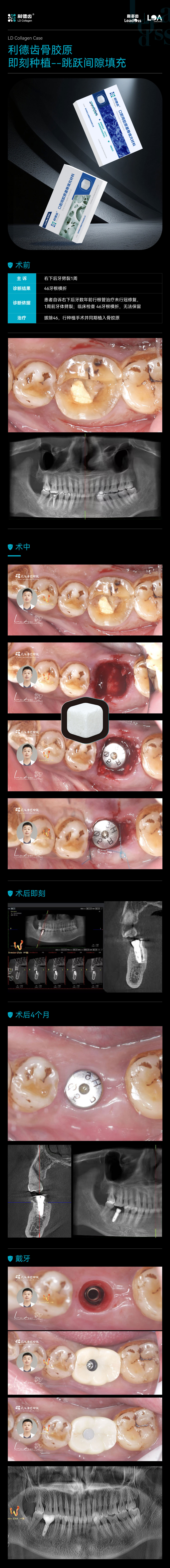 骨胶原病例4.jpg